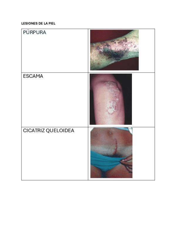 Miniatura del documento TABLA-LESIONES.pdf