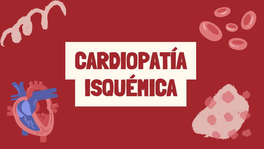 Miniatura del documento Cardiopatia-Isquemica.pdf