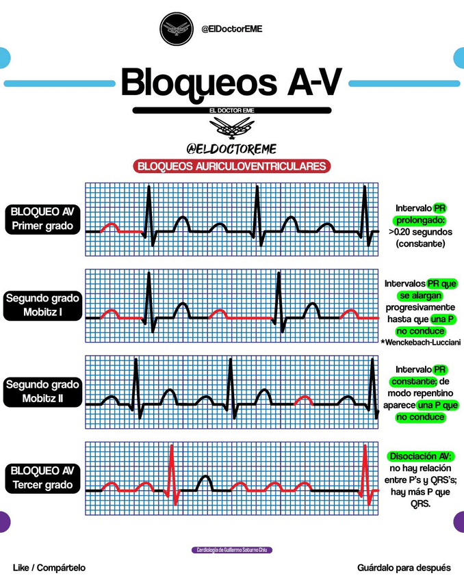 Miniatura del documento bloqueos-av.jpg