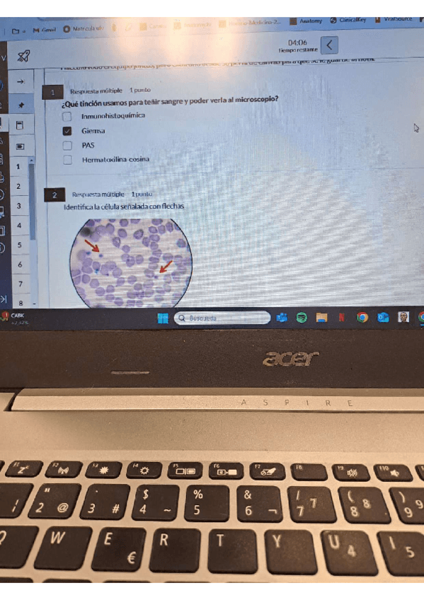 Miniatura del documento examen-histo-celulas-sangre.pdf