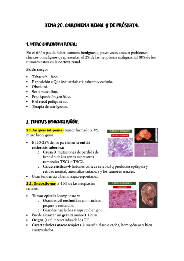 Miniatura del documento TEMA-20-CARCINOMA-RENAL-Y-DE-PROSTATA.pdf