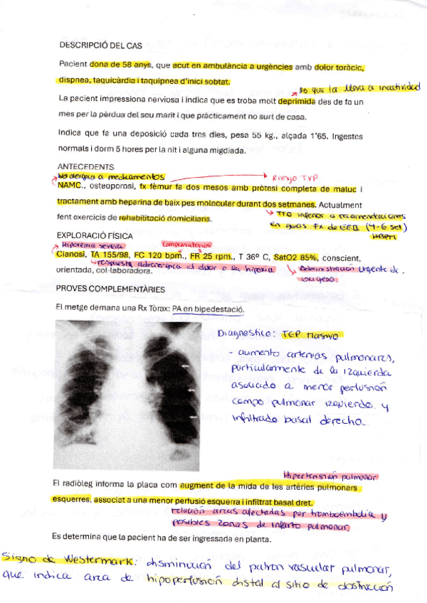Miniatura del documento Caso-clinico-4-TEP.pdf
