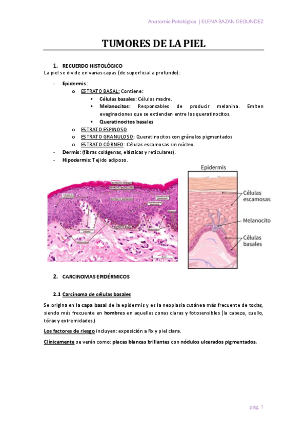 Miniatura del documento TUMORES-DE-LA-PIEL.pdf