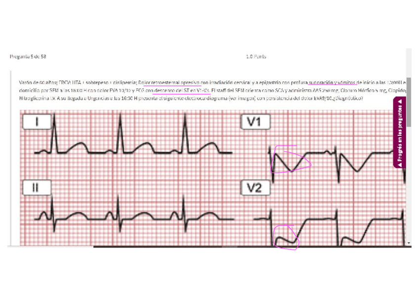 Miniatura del documento Cardio-junio-2020-Resuelto.pdf