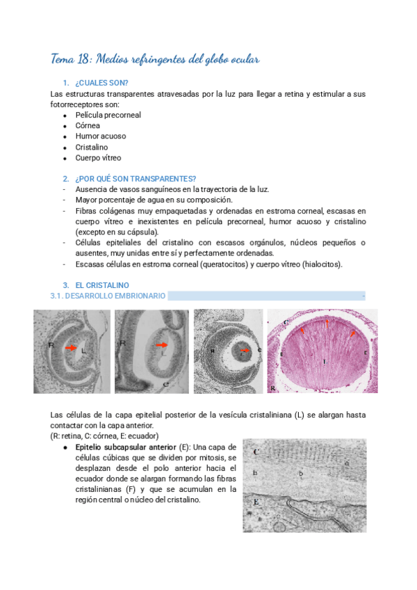 Miniatura del documento Tema-18-Medios-refringentes-del-globo-ocular.pdf