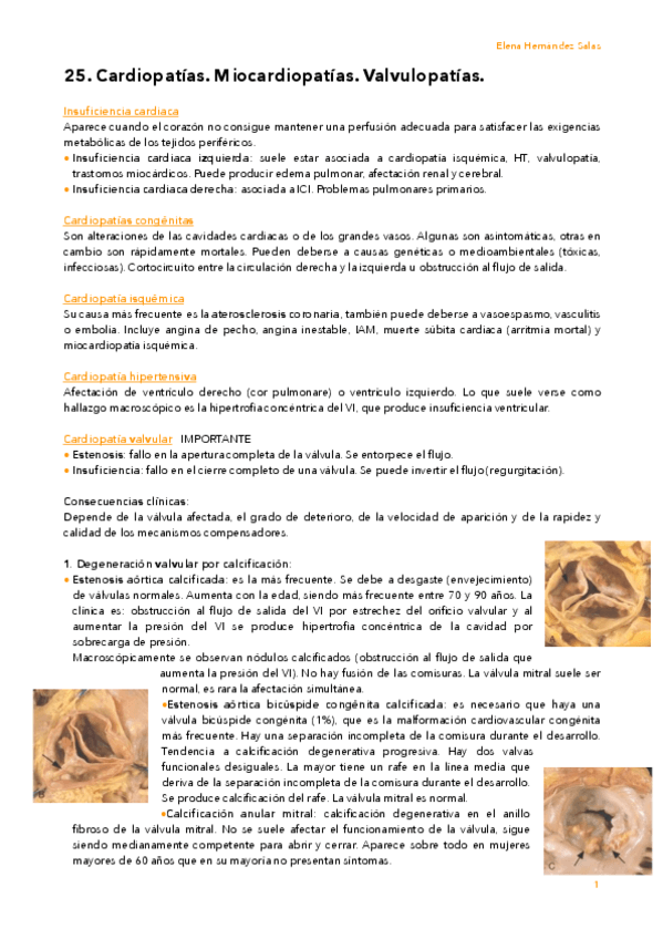 Miniatura del documento 25. Miocardiopatías. Valvulopatías.pdf