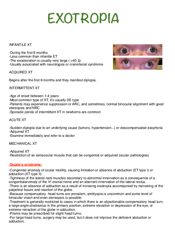 Miniatura del documento exotropia-in-strabismus.pdf