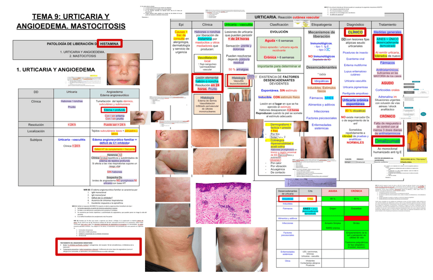 Miniatura del documento 9.-Urticaria-y-Angioedema.pdf
