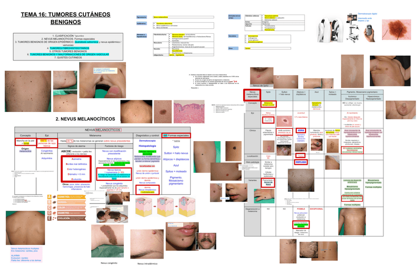Miniatura del documento 16.-Tumores-cutaneos-benignos.pdf