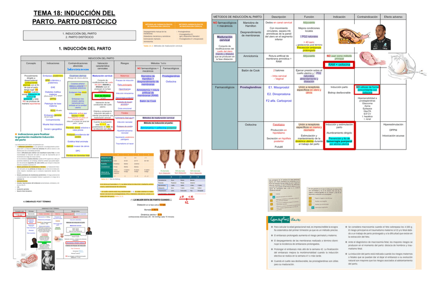 Miniatura del documento 18.-Induccion-del-Parto.-Parto-Distocico.pdf