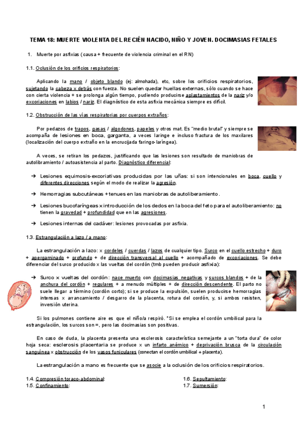 Miniatura del documento TEMA-18-MUERTE-VIOLENTA-DEL-RECIEN-NACIDO-NINO-Y-JOVEN.pdf