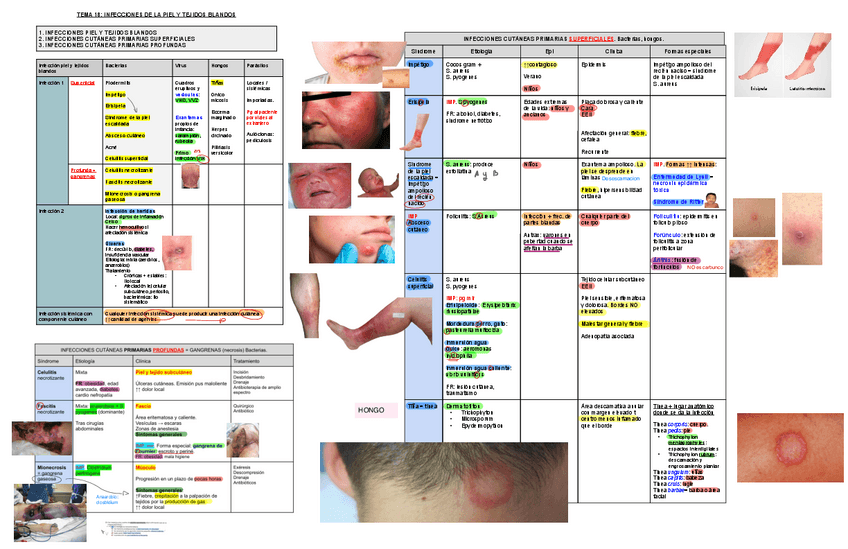 Miniatura del documento 18.-Infecciones-piel-y-tejido-blandos.pdf