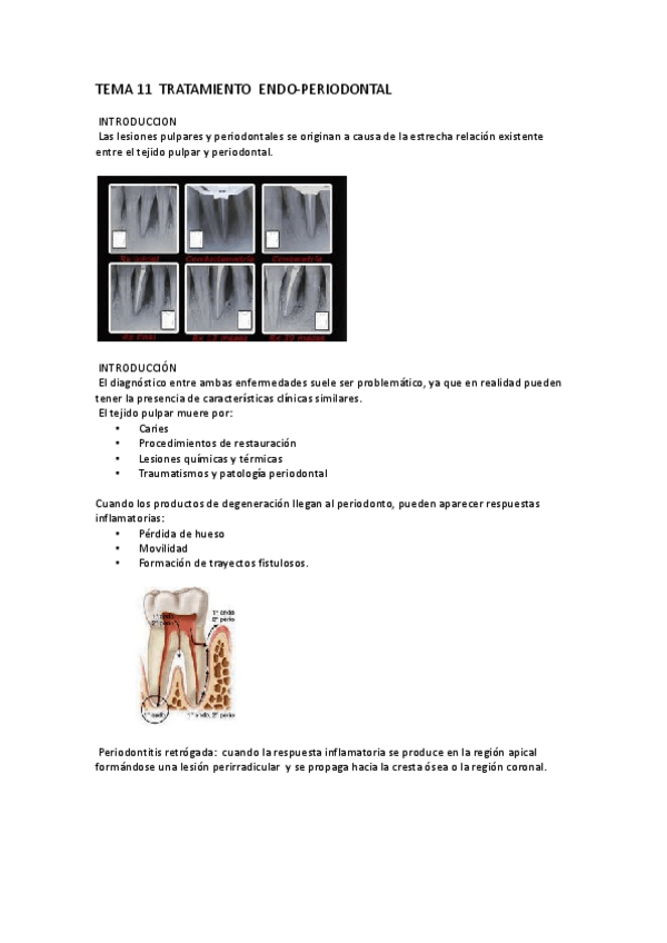 Miniatura del documento TEMA-11-TRATAMIENTO-ENDO.docx.pdf