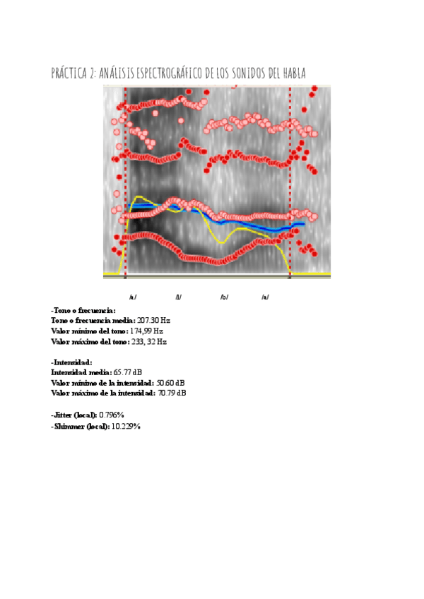 Miniatura del documento PRACTICA-2-ANALISIS-ESPECTROGRAFICO-DE-LOS-SONIDOS-DEL-HABLA.pdf