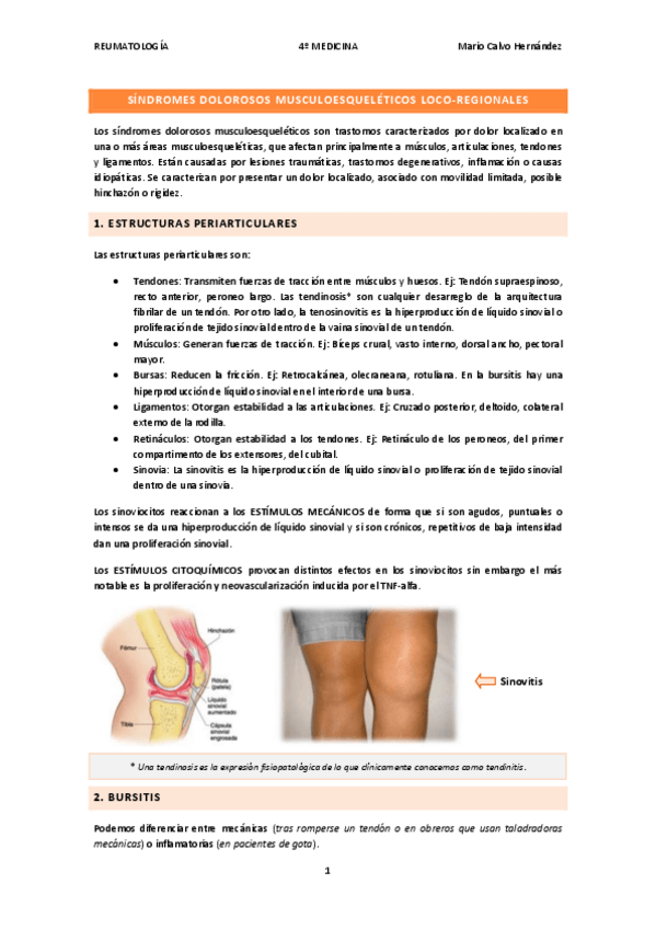Miniatura del documento SINDROMES-DOLOROSOS-MUSCULOESQUELETICOS-LOCO-REGIONALES.pdf