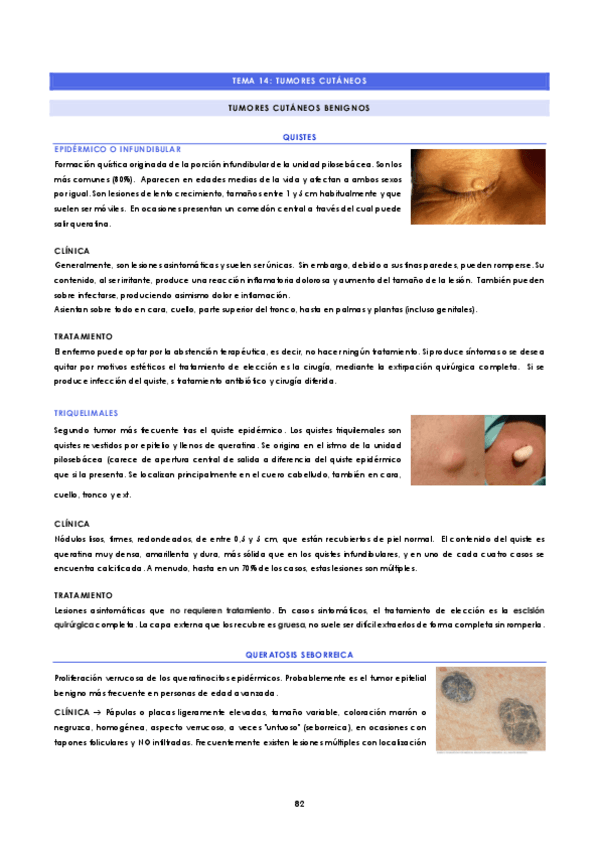Miniatura del documento TEMA-14-Tumores-cutaneos.pdf