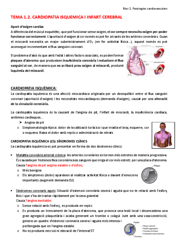 Miniatura del documento Tema-1.2.-Cardiopatia-isquemica.pdf