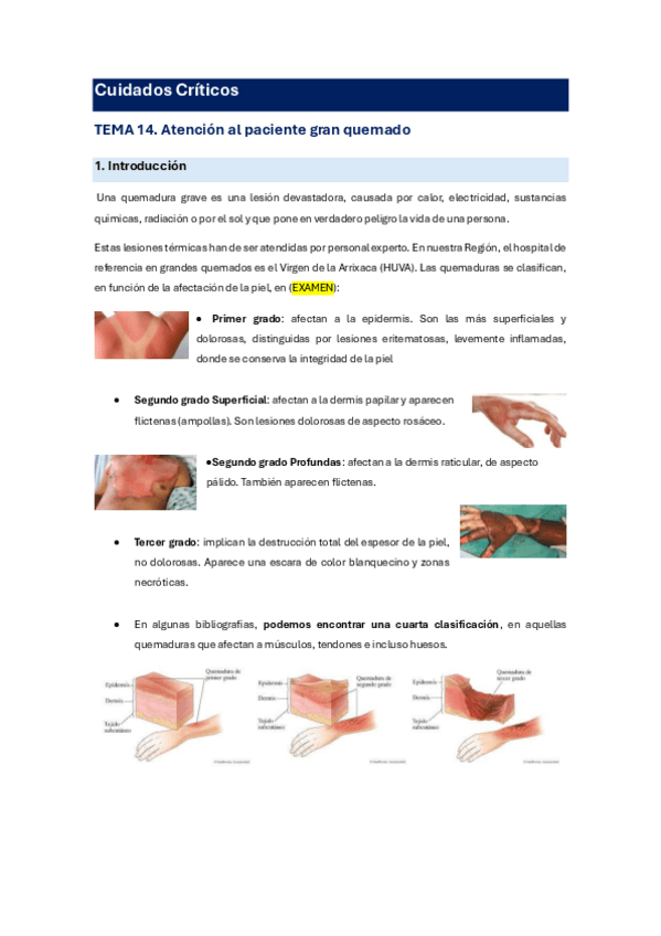 Miniatura del documento Tema-14.-Atencion-al-paciente-gran-quemado.pdf