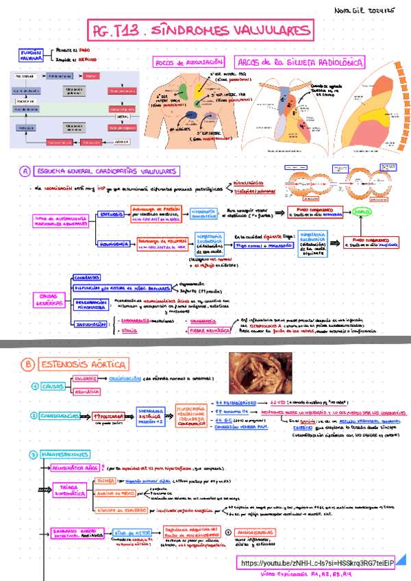 Miniatura del documento T13-SIND-VALVULARES.pdf