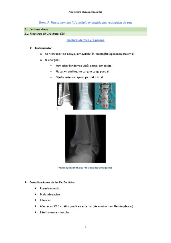 Miniatura del documento Tema-7.-Tractament-de-fisioterapia-en-patologia-traumatica-de-peu.pdf