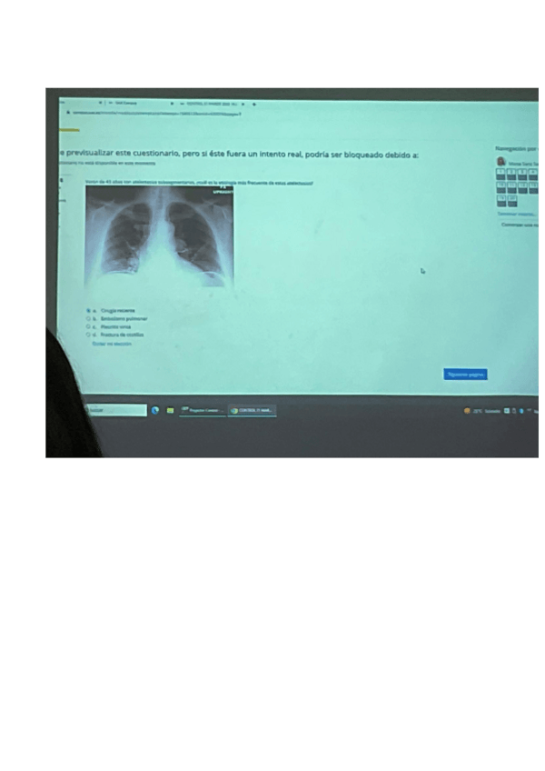 Miniatura del documento Parcial-radio-22-23.pdf