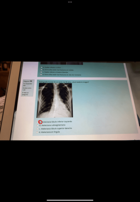 Miniatura del documento Parcial Radio Resuelto.pdf