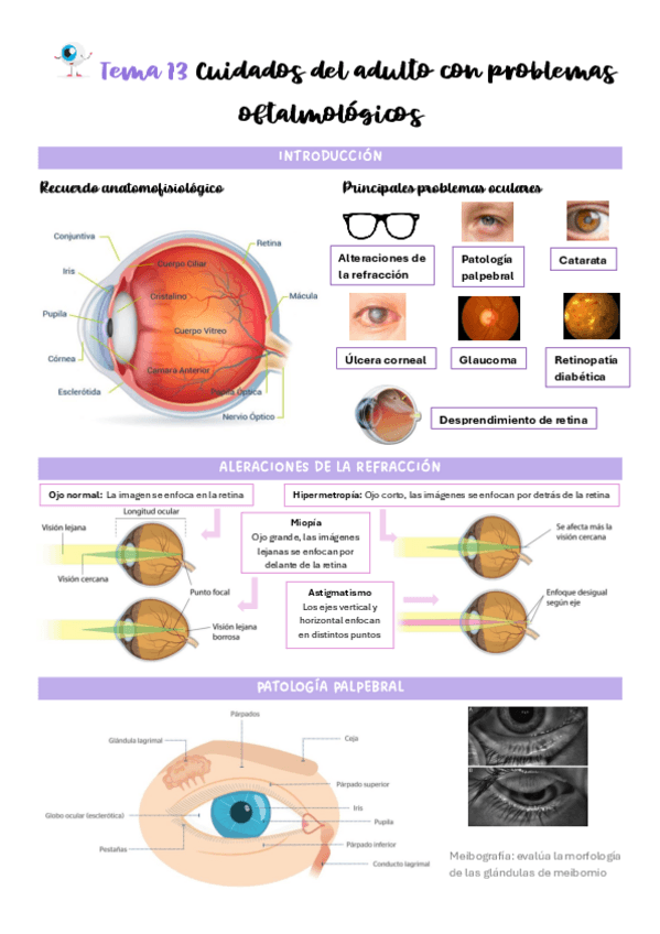 Miniatura del documento Tema-13-Cuidados-del-adulto-con-problemas-oftalmologicos.pdf