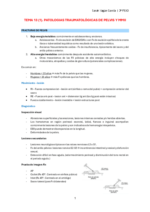 Miniatura del documento MQ-II-T13-1-Traumatologia-y-Otras-Patologias-de-la-Pelvis.pdf