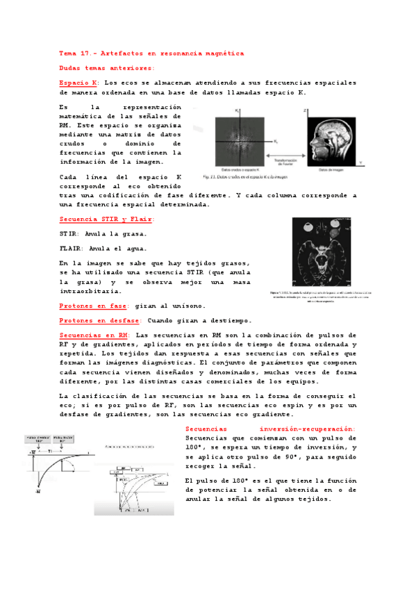 Miniatura del documento Apuntes-Tema-17.-Artefactos-en-resonancia-magnetica.pdf
