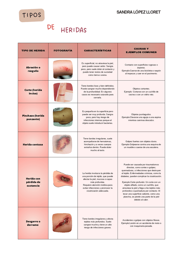 Miniatura del documento TIPOS-DE-HERIDAS.pdf