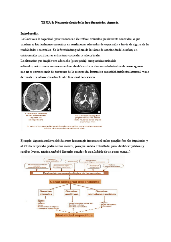 Miniatura del documento TEMA-8-Neuropsicologia-de-la-funcion-gnosica.pdf