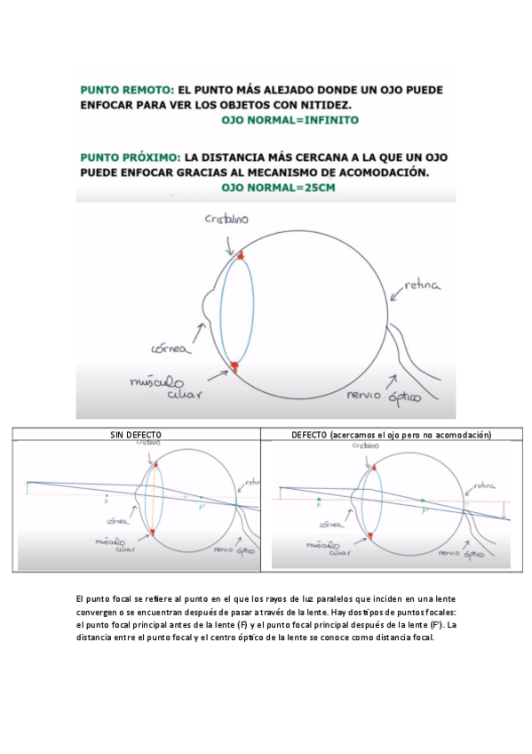 Miniatura del documento AMETROPIAS-OFTALMO.pdf