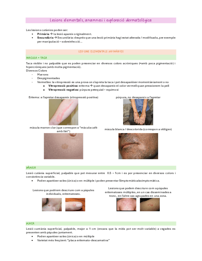 Miniatura del documento Tema-2-Lesions-elementals-anamnesi-i-exploracio-dermatologica.pdf