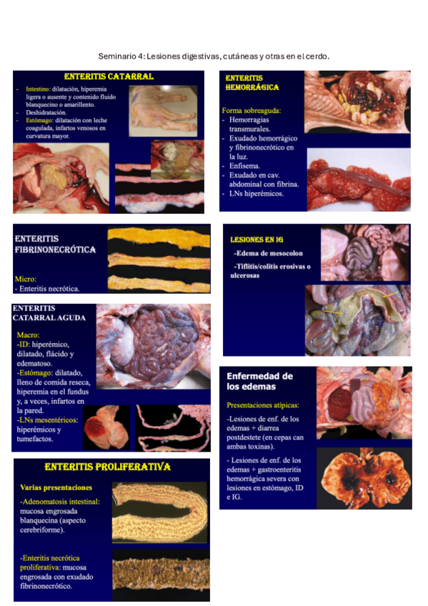 Miniatura del documento Seminario-postmortem-4-y-5.pdf