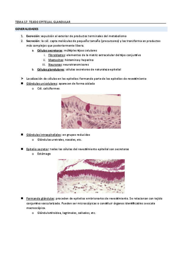 Miniatura del documento TEMA-17.2EPITELIOS-GLANDULARES-Y-GLANDULAS.pdf