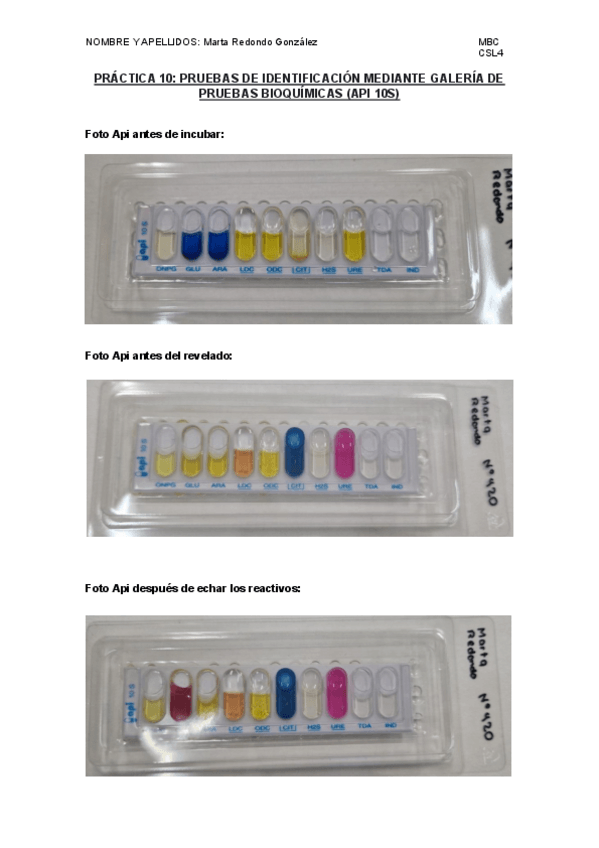 Miniatura del documento PRUEBAS-DE-IDENTIFICACION-MEDIANTE-GALERIA-DE-PRUEBAS-BIOQUIMICAS-API-10S.pdf