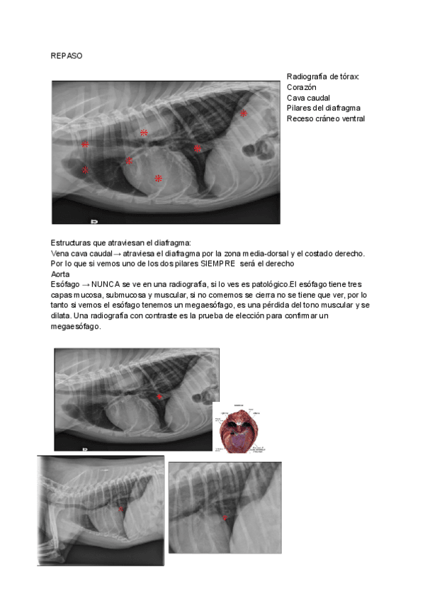 Miniatura del documento TORAX-2.pdf