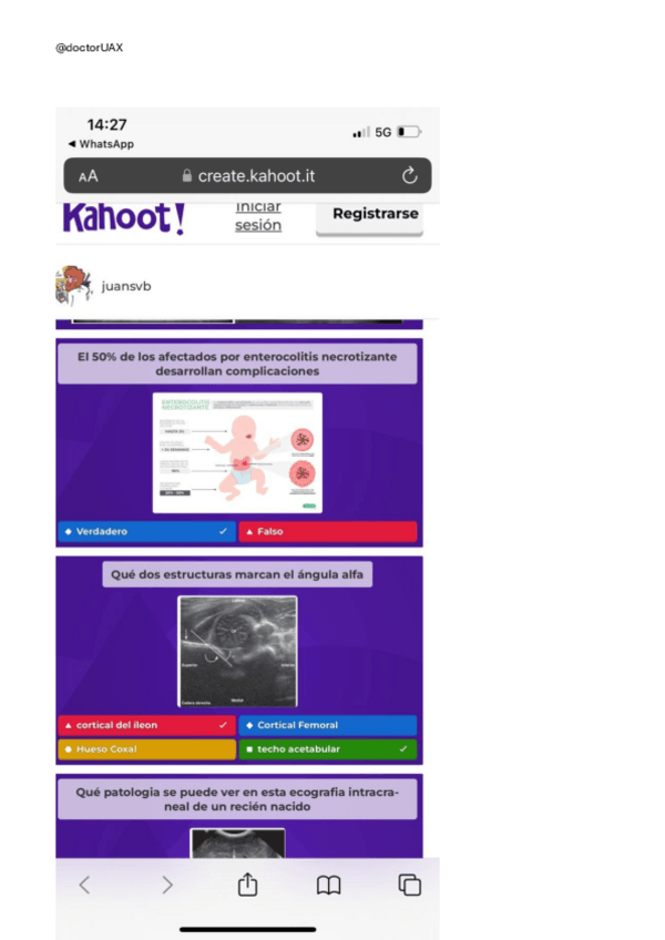Miniatura del documento recopilacion-kahoots-de-radiologia.pdf