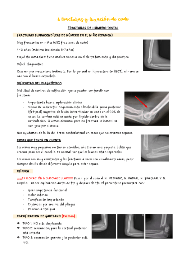 Miniatura del documento 6-Fracturas-y-luxacion-de-codo.pdf