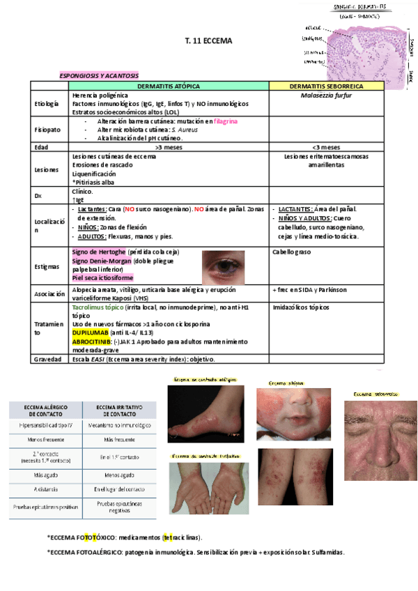 Miniatura del documento ECCEMA-DERMATITIS-ATOPICA-vs-DERMATISIS-SEBORREICA.pdf