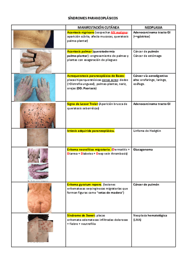 Miniatura del documento SINDROMES-PARANEOPLASICOS.pdf