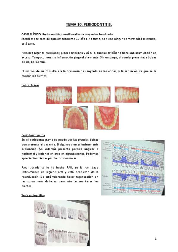 Miniatura del documento TEMA-10-PERIODONTITIS.-PERIODONCIA-I..pdf