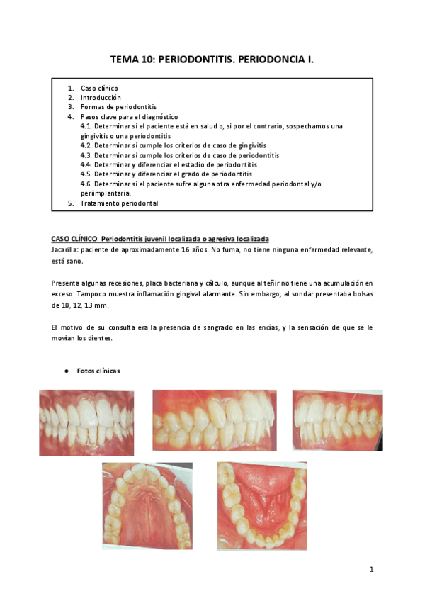 Miniatura del documento TEMA-10-PERIODONTITIS-II.pdf