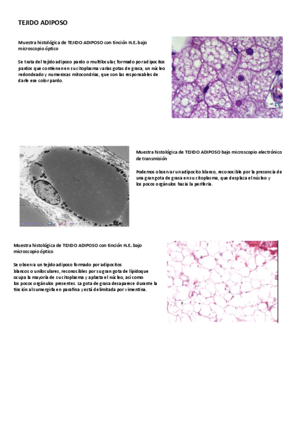 Miniatura del documento Seminario-tejido-adiposo.pdf