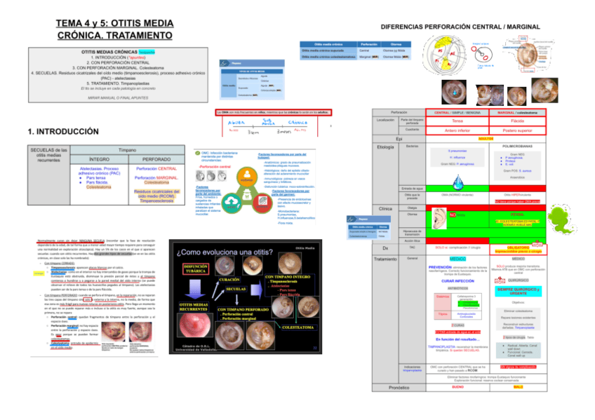 Miniatura del documento 4-5-OTITIS-MEDIA-CRONICA.-TRATAMIENTO.pdf
