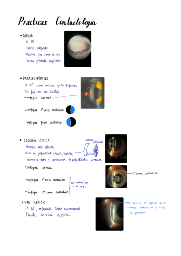 Miniatura del documento Lampara-de-Hendidura.pdf