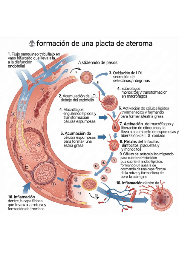 Miniatura del documento Formacion-placa-de-ateroma-esquema.pdf