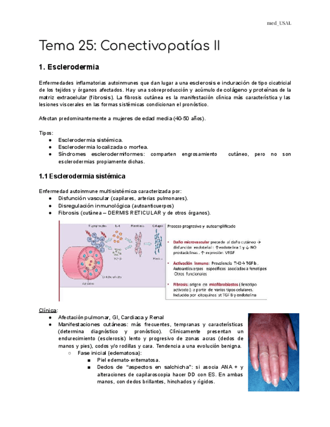 Miniatura del documento Tema-25-Conectivopatias-II.pdf