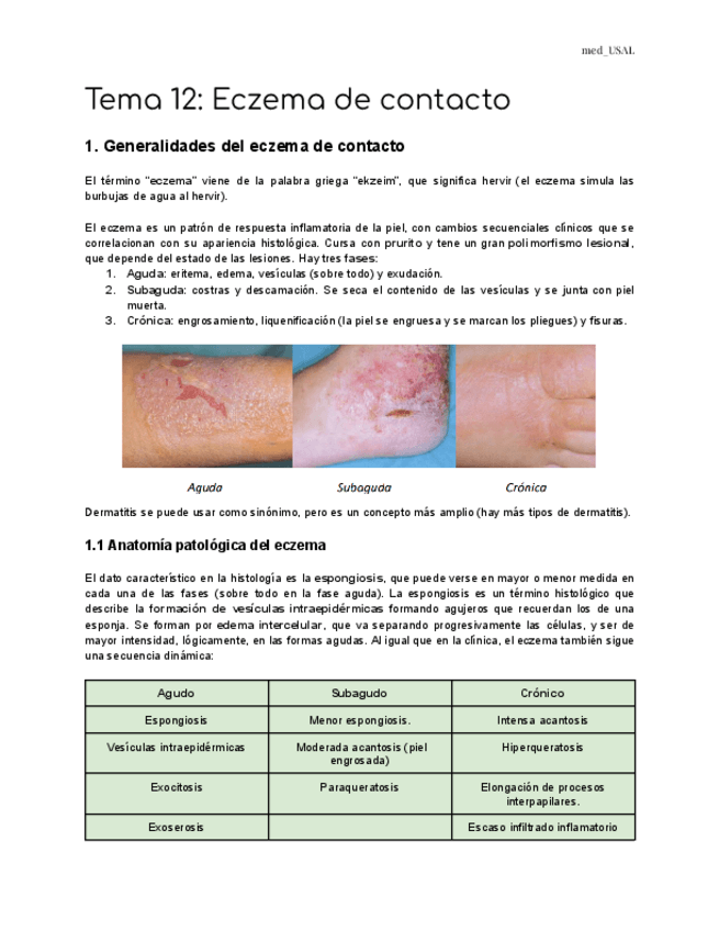 Miniatura del documento Tema-12-Eczema-de-contacto.pdf