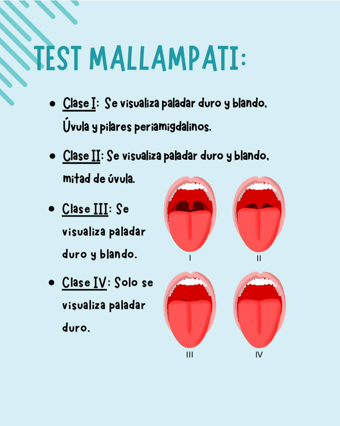 Miniatura del documento Test-mallampati.pdf